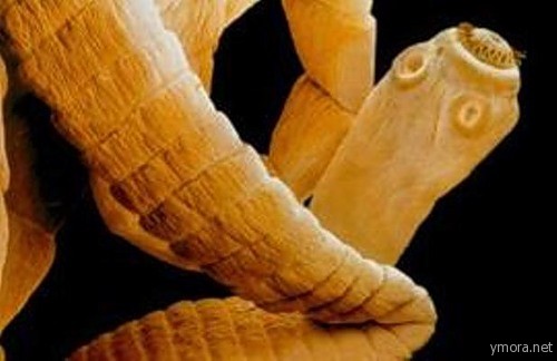 Цветной микроснимок сканирующего электронного микроскопа (СЭМ) паразитического ленточного червя (Taenia sp.). На сколексе (голова, справа) имеются присоски (справа выше) и венчик из крючьев (справа сверху) которыми червь пользуется, чтобы прикрепиться к внутренней стороне кишки своего носителя. В конце сколекса узкая шейка, от которой отрастают новые сегменты тела ( проглоттиды - членики тела у ленточного червя). У ленточного червя нет специализированной пищеварительной системы, но они питаются наполовину переваренной пищей в кишке, путем прямого всасывания через всю поверхность кожи. Ленточный червь может вызывать диарею, потерю веса и ощущение дискомфорта в животе. Увеличение: x15 при размере в 5x7 см.
