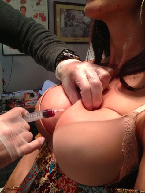 Вампирская подтяжка груди - новая жутковатая процедура для посетительниц салонов красоты