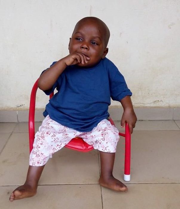 Бездомный мальчик, страдавший от недоедания, пошел на поправку