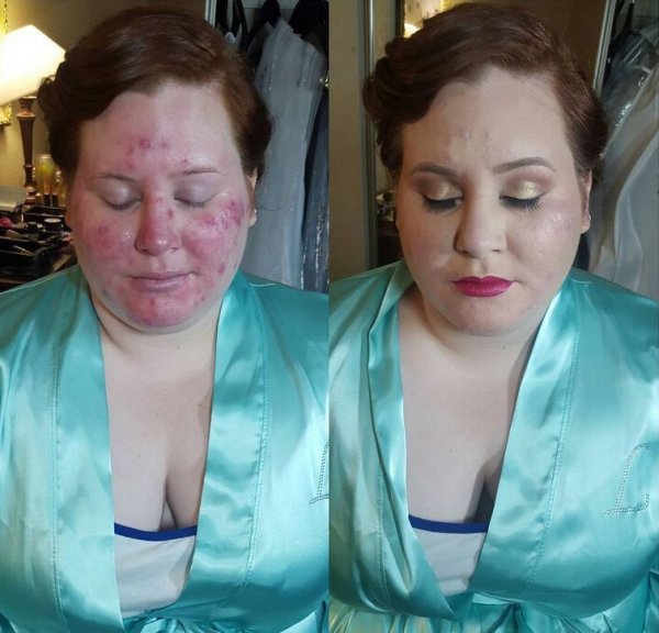 Девушки, умело маскирующие свою проблемную кожу при помощи макияжа