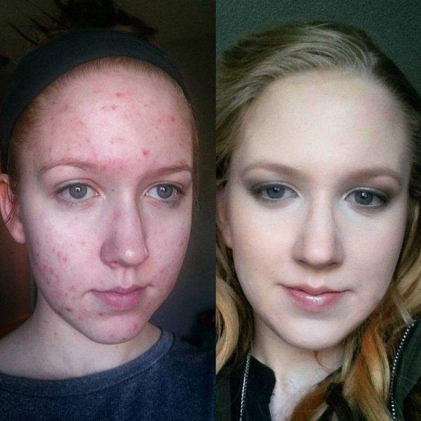 Девушки, умело маскирующие свою проблемную кожу при помощи макияжа