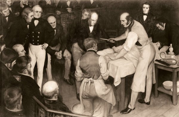 Ужасы викторианской хирургии: подробные иллюстрации