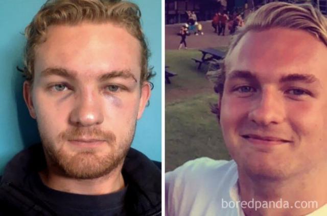 До и после: как меняется внешность человека, который перестает пить