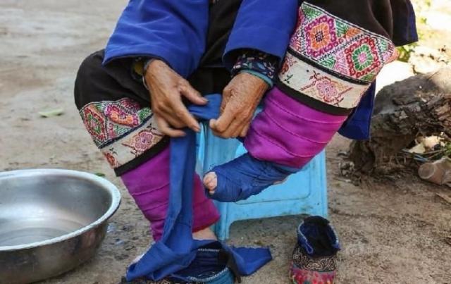 Пожилые китаянки с деформированными стопами