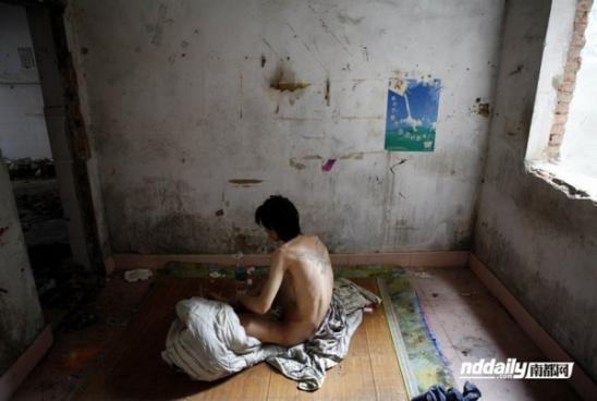 Голые Гуйлинь Ву, наркоман в провинции Гуандун Китая, сидит в своем ветхом доме, ноги инфицированных поэтому он не может ходить на задних лапах.